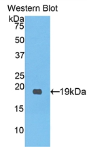 Polyclonal Antibody to Procollagen C-Endopeptidase Enhancer (PCOLCE)