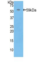 Polyclonal Antibody to Perforin 1 (PRF1)