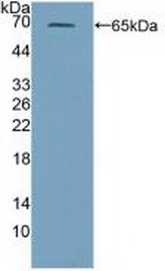 Polyclonal Antibody to Perforin 1 (PRF1)