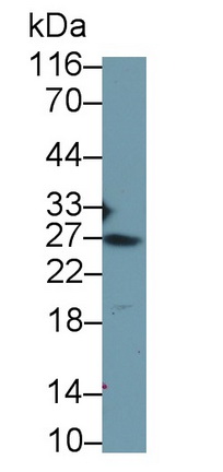 Polyclonal Antibody to Thymic Stromal Lymphopoietin (TSLP)