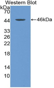 Polyclonal Antibody to Thymic Stromal Lymphopoietin (TSLP)