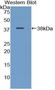 Polyclonal Antibody to Calcineurin (CaN)