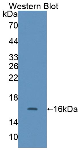 Polyclonal Antibody to Caldesmon (CALD)