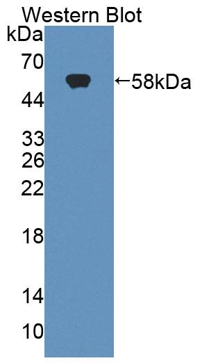 Polyclonal Antibody to Tenascin R (TNR)