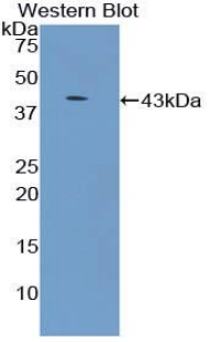 Polyclonal Antibody to Microtubule Associated Protein 2 (MAP2)