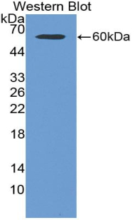 Polyclonal Antibody to Microtubule Associated Protein 2 (MAP2)