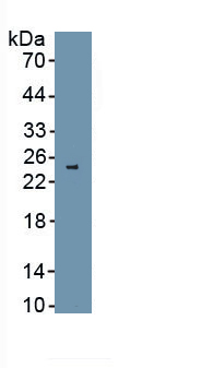 Polyclonal Antibody to Melanoma Associated ME20 (ME20M)