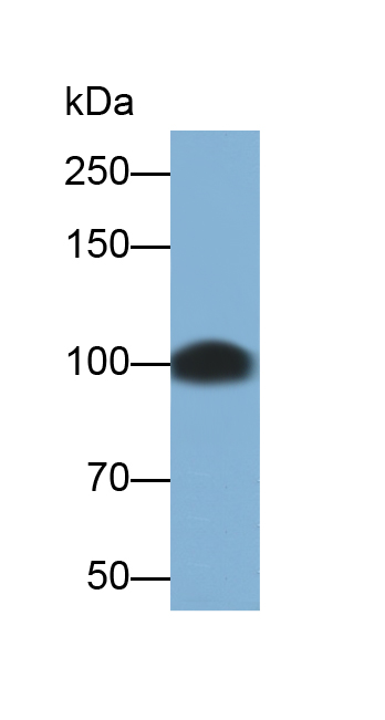 Polyclonal Antibody to Involucrin (INV)