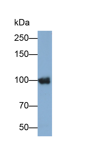 Polyclonal Antibody to Involucrin (INV)