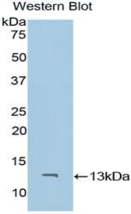 Polyclonal Antibody to Cluster of Differentiation 59 (CD59)