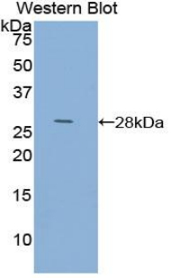 Polyclonal Antibody to Actin Alpha 1, Cardiac Muscle (ACTC1)