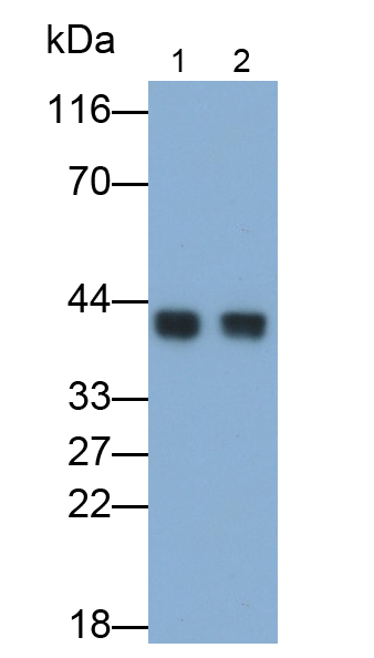 Polyclonal Antibody to Actin Gamma 2, Smooth Muscle (ACTg2)