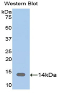 Polyclonal Antibody to Adenylyl Cyclase Associated Protein 1 (CAP1)