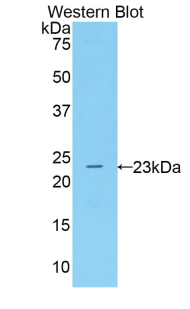 Polyclonal Antibody to 5-Lipoxygenase (5-LO)