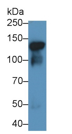 Polyclonal Antibody to Cadherin 5 (CDH5)