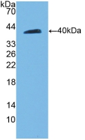 Polyclonal Antibody to Cadherin 5 (CDH5)