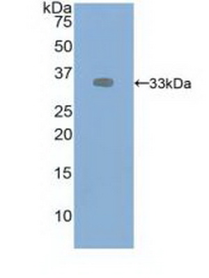 Polyclonal Antibody to Vascular Endothelial Growth Factor Receptor 2 (VEGFR2)