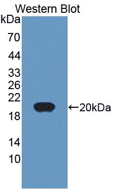 Polyclonal Antibody to Cluster Of Differentiation 74 (CD74)