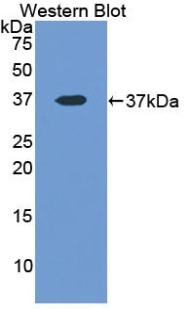 Polyclonal Antibody to Lactate Dehydrogenase A (LDHA)