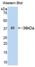 Polyclonal Antibody to Lactate Dehydrogenase A (LDHA)