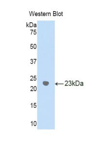 Polyclonal Antibody to Gamma-Glutamyltransferase 1 (gGT1)