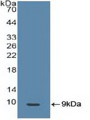 Polyclonal Antibody to Breast Cancer Susceptibility Protein 1 (BRCA1)