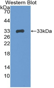 Polyclonal Antibody to Breast Cancer Susceptibility Protein 1 (BRCA1)