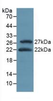 Polyclonal Antibody to Activating Transcription Factor 4 (ATF4)