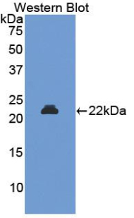 Biotin-Linked Polyclonal Antibody to Neutrophil gelatinase-associated lipocalin (NGAL)