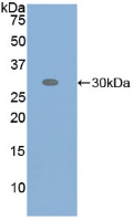 Polyclonal Antibody to Activating Transcription Factor 6 (ATF6)