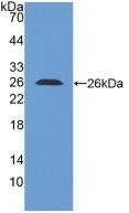 Polyclonal Antibody to Leukocyte Immunoglobulin Like Receptor Subfamily B, Member 1 (LILRB1)