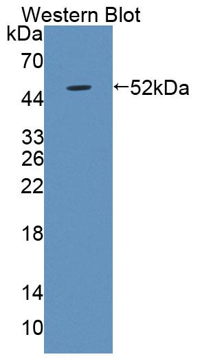 Polyclonal Antibody to Lipopolysaccharide Binding Protein (LBP)