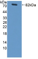 Polyclonal Antibody to Lipopolysaccharide Binding Protein (LBP)