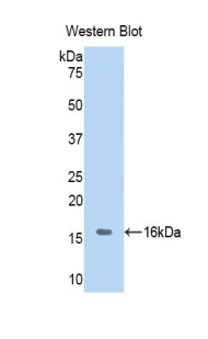 Polyclonal Antibody to Hemoglobin (HB)