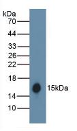 Polyclonal Antibody to Hemoglobin (HB)