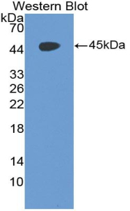 Polyclonal Antibody to Cluster Of Differentiation 97 (CD97)