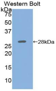 Polyclonal Antibody to Adenylate Cyclase 5 (ADCY5)