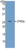 Polyclonal Antibody to Glucuronidase Beta (GUSb)