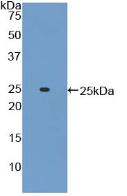 Polyclonal Antibody to Adenylate Cyclase 6 (ADCY6)