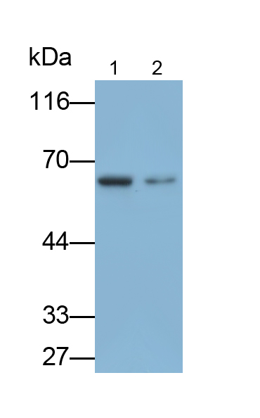 Polyclonal Antibody to Dopamine Beta Hydroxylase (DbH)