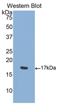 Polyclonal Antibody to Semaphorin 4D (SEMA4D)