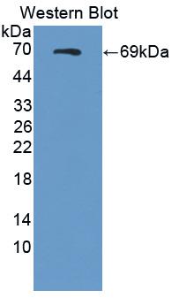 Polyclonal Antibody to Semaphorin 4D (SEMA4D)