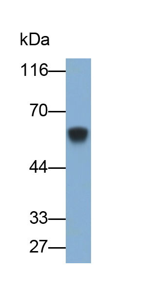 Polyclonal Antibody to Tyrosine Hydroxylase (TH)