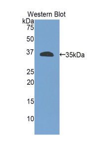 Polyclonal Antibody to Integrin Beta 4 (ITGb4)