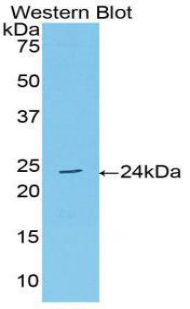 Polyclonal Antibody to Acetylcholinesterase (ACHE)