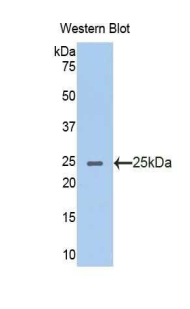 Polyclonal Antibody to Acetylcholinesterase (ACHE)