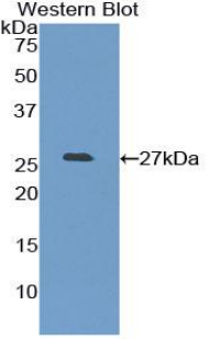 Polyclonal Antibody to Pancreatic Lipase (PL)