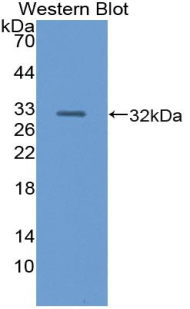 Polyclonal Antibody to Pancreatic Lipase (PL)