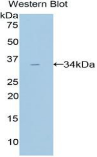 Polyclonal Antibody to Amylase, Alpha 2A (AMY2A)