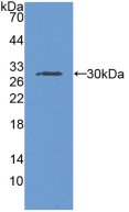 Polyclonal Antibody to Aminopeptidase B (RNPEP)